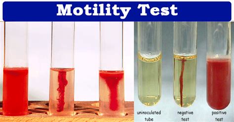 test tube with soft agar purpose|7.7: Testing for Bacterial Motility .